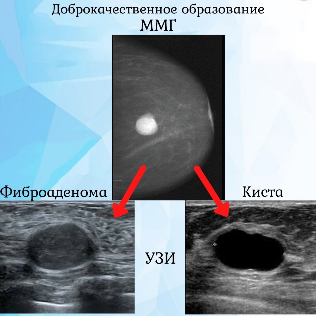 На какой день цикла делать узи груди и матки?