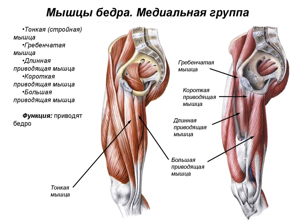 Что такое межпозвонковая грыжа?