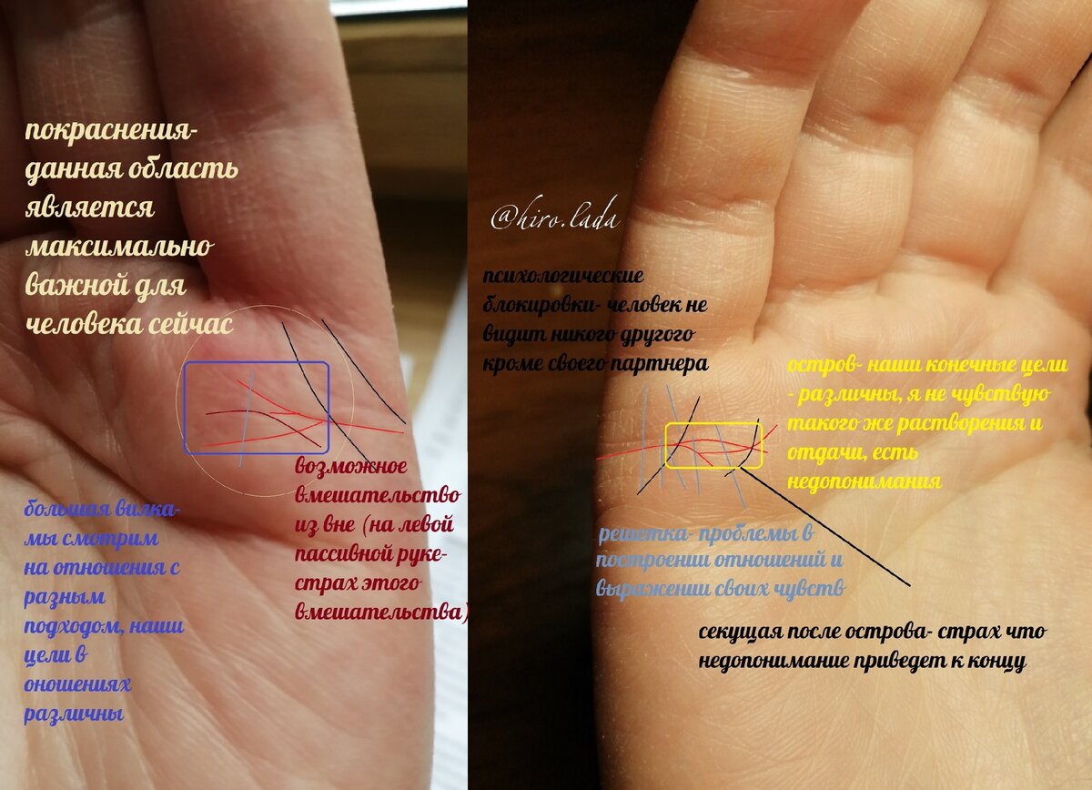 Брак на руке фото с расшифровкой. Линия брака на руке в картинках. Линия брака на руке женщины. Линии брака на руке Возраст. Линии замужества на руке у женщины.