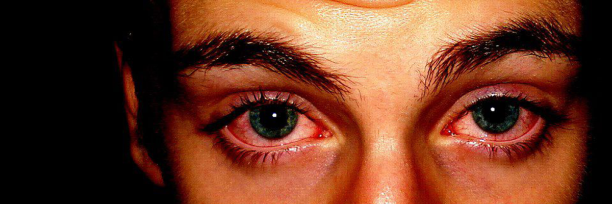 От конопли краснеют глаза сколько выветривается марихуана из организма