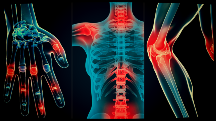 Или хотя бы уменьшить. 