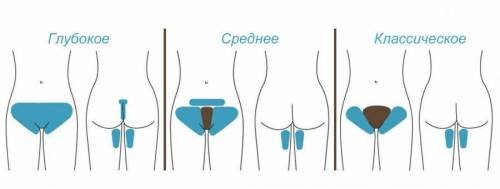 
Эпиляция зоны бикини может носить и другие названия, однако обрабатываемые области при этом неизменны