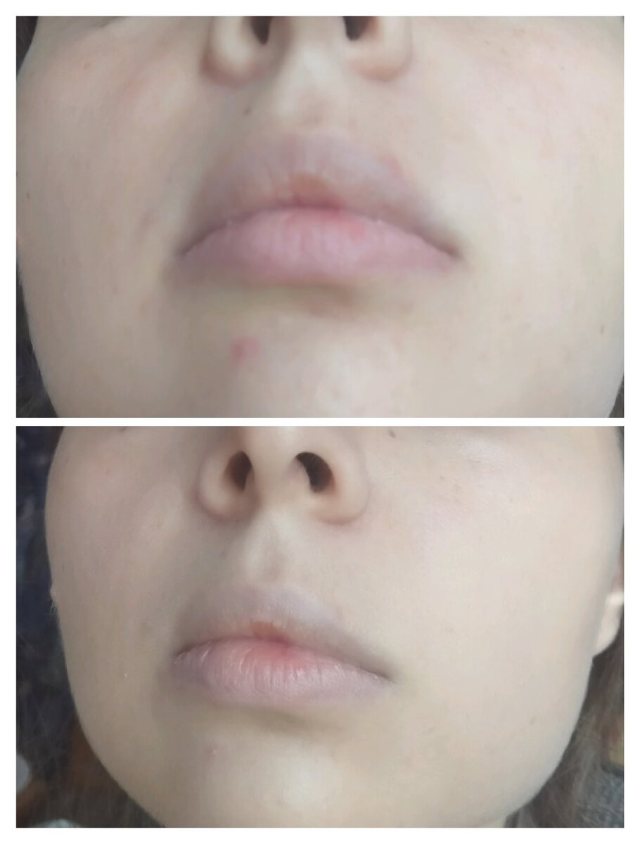 Beauty-красота