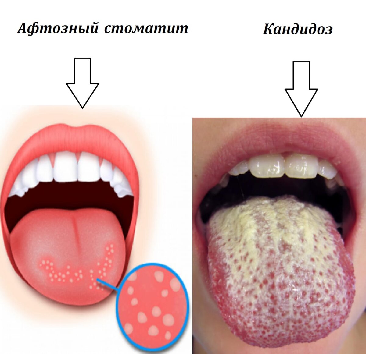 Аккуратнее с кунилингусом и минетиком, родненькие