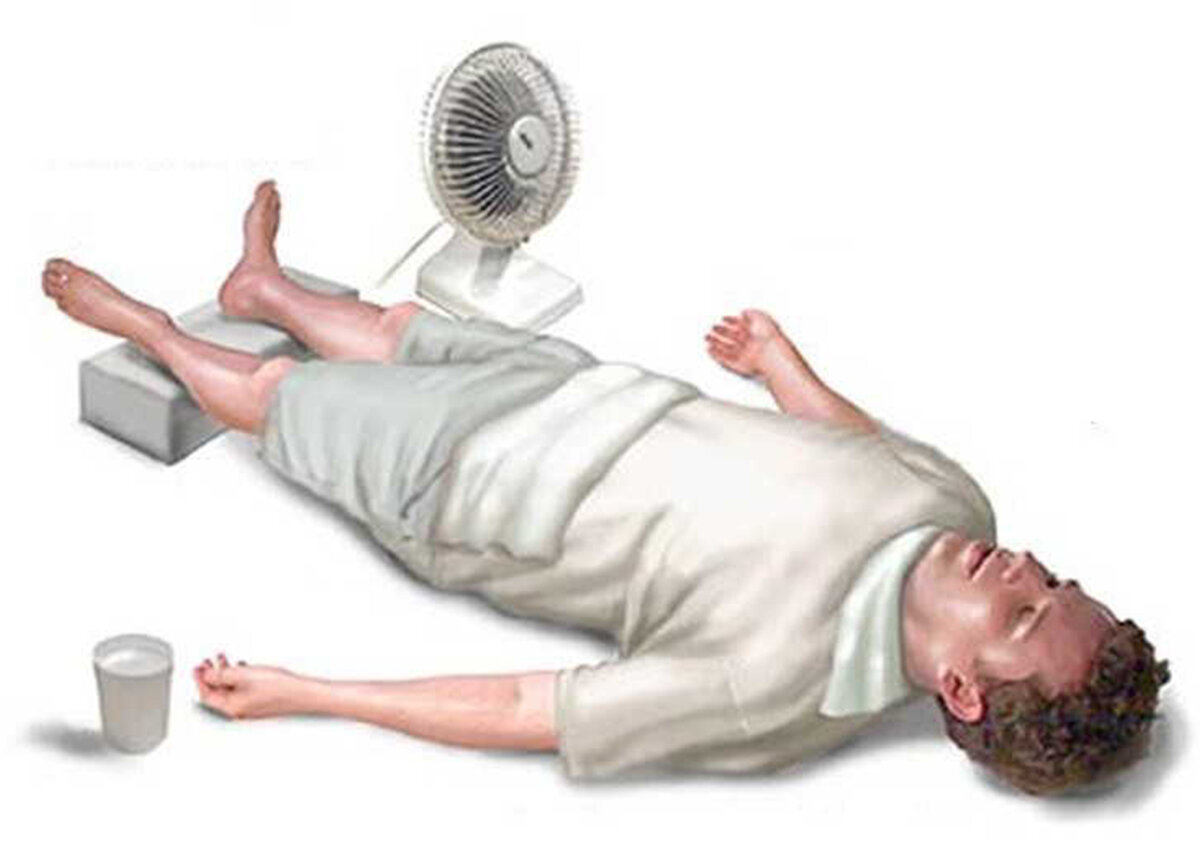 солнечный и тепловой удар оказание первой помощи. обмороки после коронавируса. обмороке тепловом ударе. оказание первой помощи при обмороке тепловом и солнечном ударе. обмороке тепловом ударе.