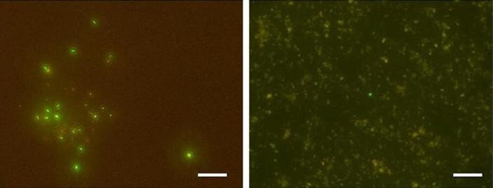 Используя методы флуоресцентной микроскопии, исследователи определили количество микроорганизмов в различных образцах. Несколько микроорганизмов были обнаружены слева в образце, взятом в 652 метрах от дна океана (температура 76 ° C). Справа только один был идентифицирован в центре образца, взятого на глубине 1176,8 метра (120 ° C).