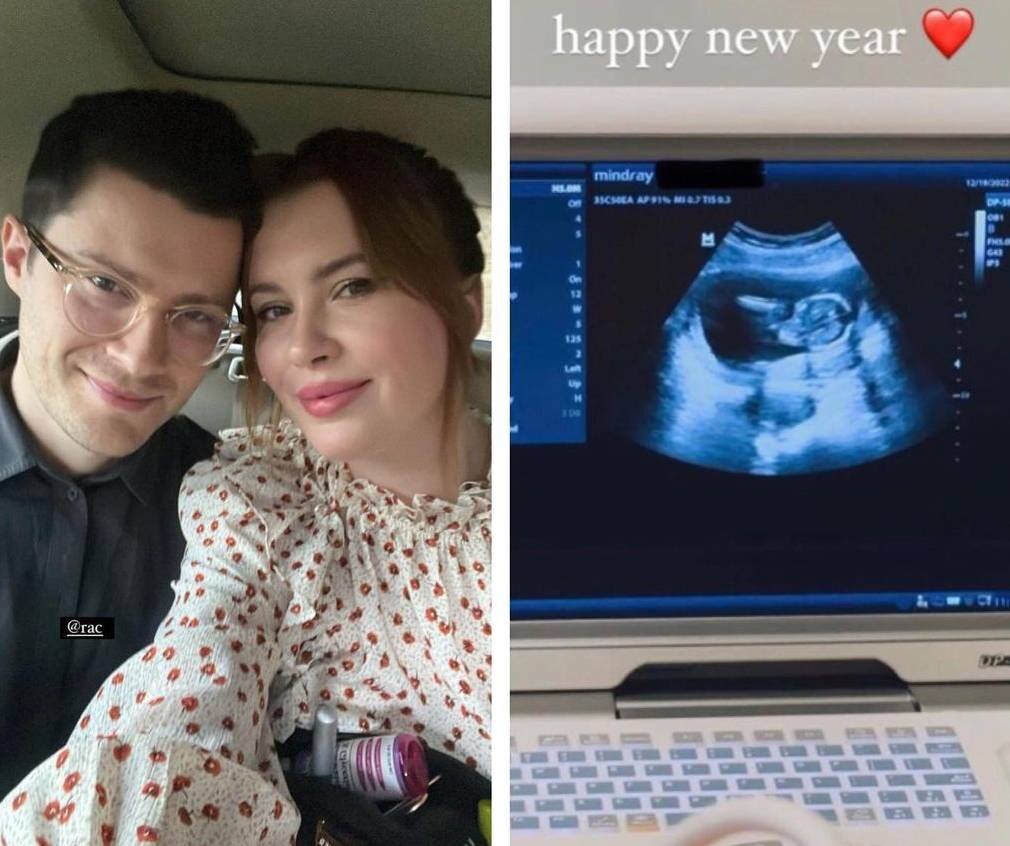    Айрленд Болдуин сообщила, что беременна от Андре Аллена АньосаСоцсети Айрленд Болдуин