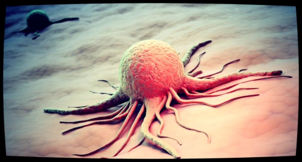 Так в чем же дело?