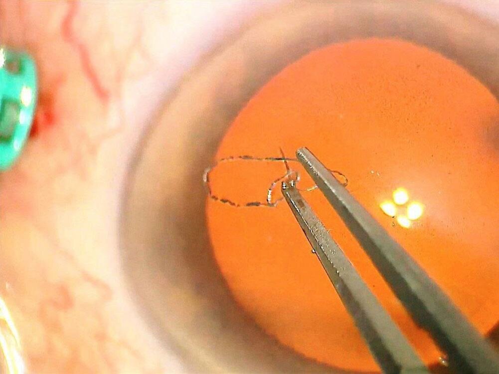    фото: ФГБУ НМХЦ им. Н.И. Пирогова Минздрава России