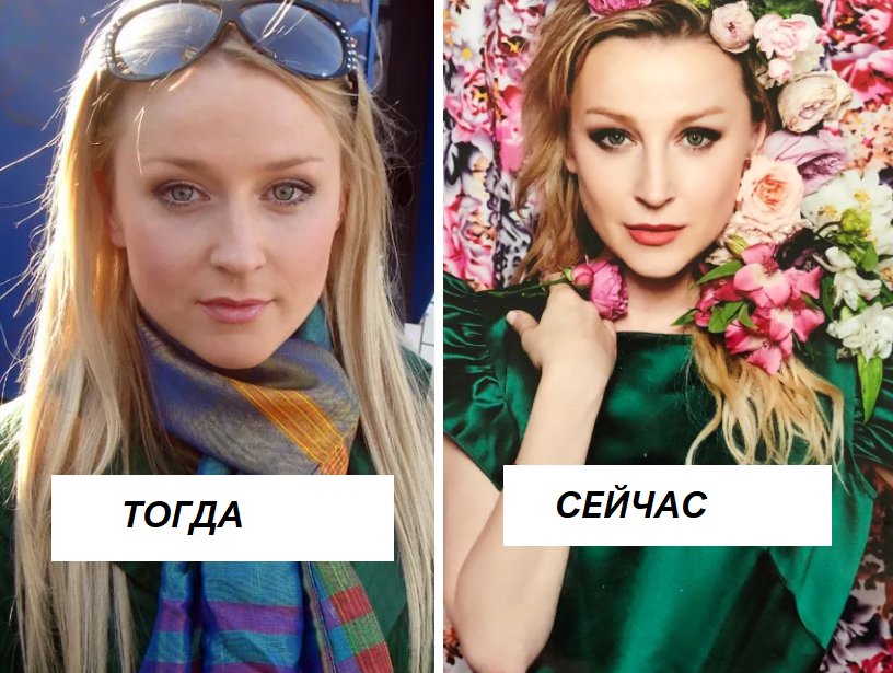 Медынич ольга до операции и после фото