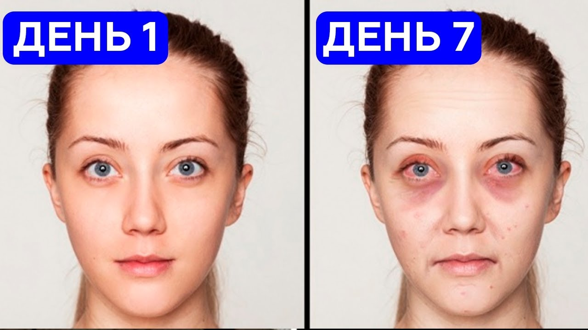 Третья неделя без еды. 15 кг за месяц. Живот на 2 месяце беременности. Голодание до и после. Водное голодание до после.