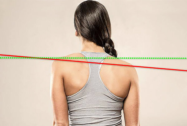 Одно плечо выше другого