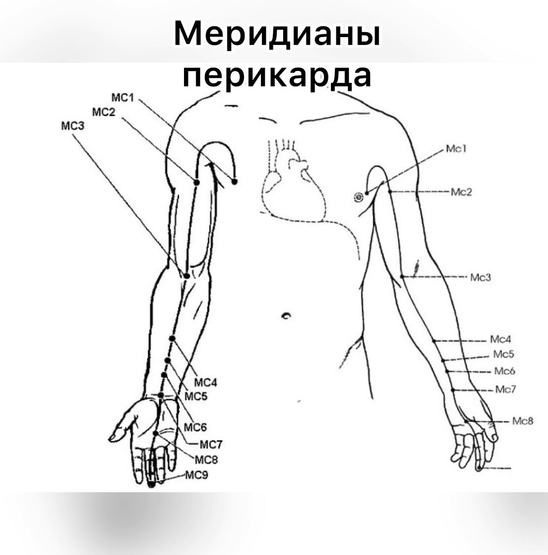 Положение меридианов перикарда