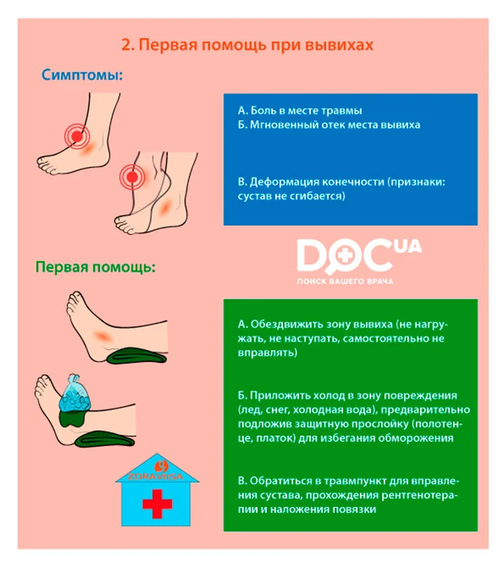 Оказание первой помощи при растяжении связок. Первач помощь пои вывихе. Оказание 1 помощи при растяжении связок.