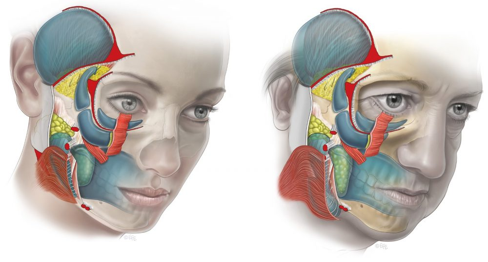 Процесс старения лица