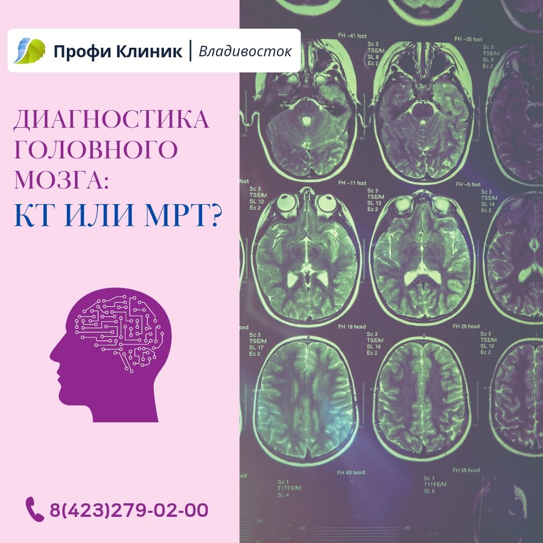 Кт головы. Кт мозга вредно. Внутримозговое кровоизлияние кт. Человек в томографе. Метастазы головного мозга кт кт.