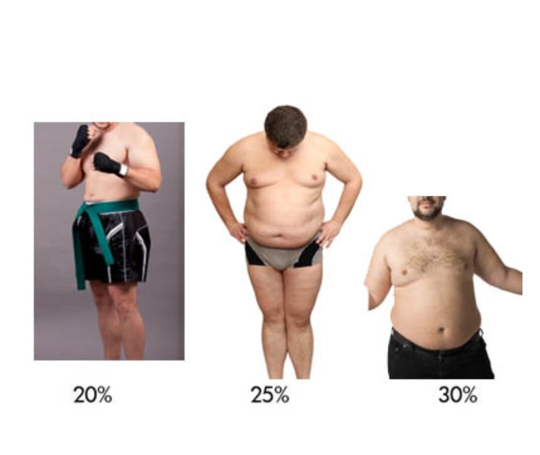 Степени ожирения. Ожирение 1 степени у мужчин. 5 этап мужчины