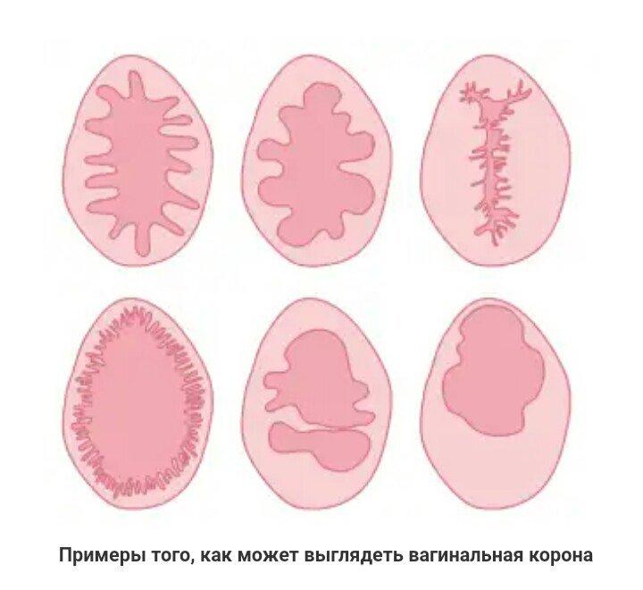 На картинке представлены далеко не все формы, их могут быть десятки.