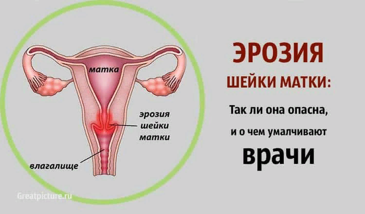 Яндекс Картинки