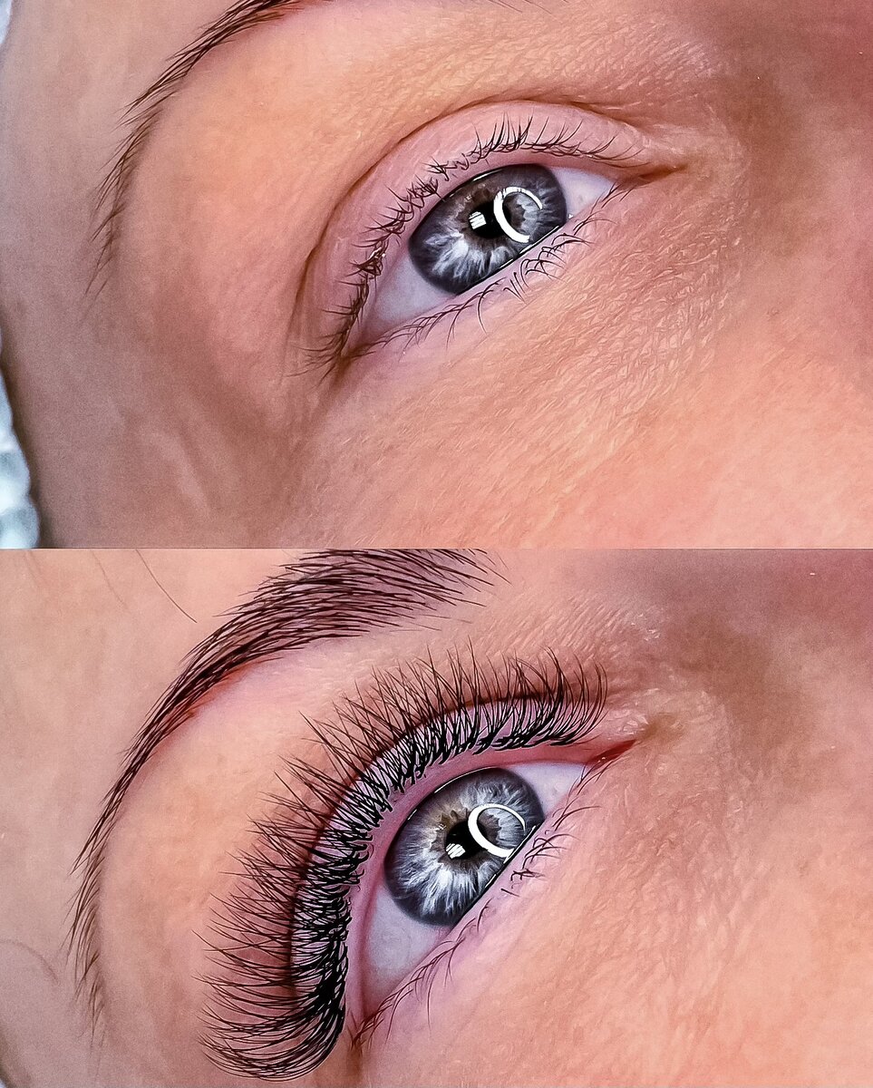 Факторов на самом деле очень много! Но это не что из разряда не спать в подушку и прочая дичь😅
Что же все таки может повлиять на носку:
🦩Смена своих ресниц. У наших ресниц происходит обмен раз в три месяца.
🦩Сбой гормонального фона. Прием гормональных препаратов.
🦩Перенесенный не за долго наркоз.
🦩Прием антибиотиков.
🦩Клей на котором работает мастер.
🦩Количество клея на ресницых. Если его мало то носка значительно меньше. Клея должно быть умеренное количество.
🦩Нервные срывы/сильный стресс.
Все эти факторы могут влиять на носку ресниц, с учетом того если вы всегда ходили к одному мастеру и носка всегда была хорошая и вдруг что то пошло не так😑
Квалифицированный мастер всегда найдет причину не долгой носки ресниц 😉👌🏽 #Косметологэстетист #Ресницымосква #обучениересницаммосква #ресницыарбат #москвасити #перманентмосква #перманентгубмосква #кутузовскийпроспект 