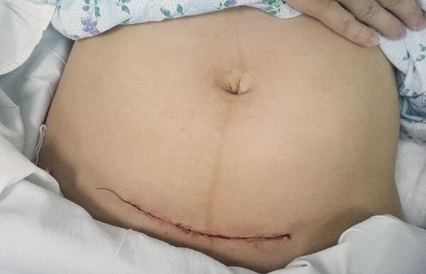 Фото из открытых источников. Способ родовспоможения почти не влияет на грудное вскармливание. Учёные рассчитали, что после КС кормят на 1-2 недели меньше, чем после ЕР (в среднем 20-22 недели). Всё, все различия.