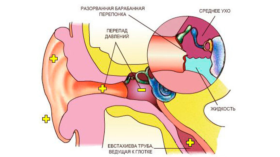 Давление болят уши