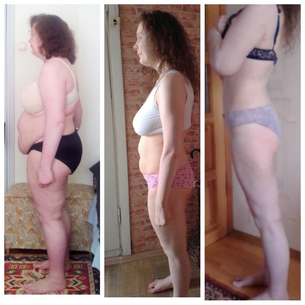 Почему остановился вес при похудении. Обвисшая кожа похудение. Похудение до и после. После похудения обвисла. Похудение после родов.