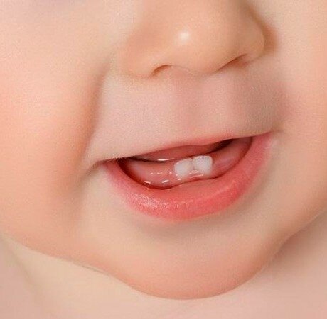 Почему важно обратиться к стоматологу до прорезывания зубов у ребенка
