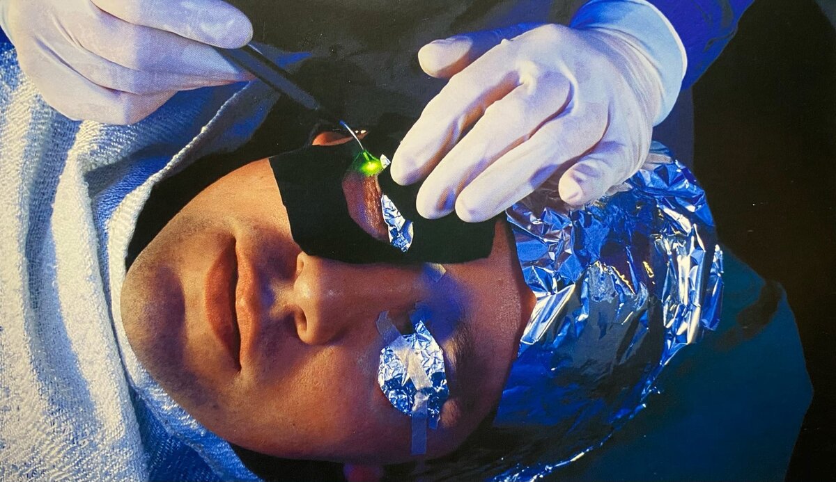 Лазер применяют в медицине, начиная с 1961 года.