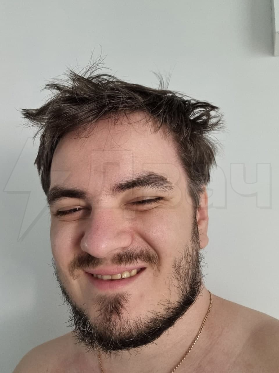 -2