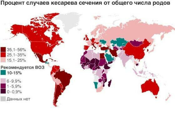 Во всем мире увеличилось количество операционных родов