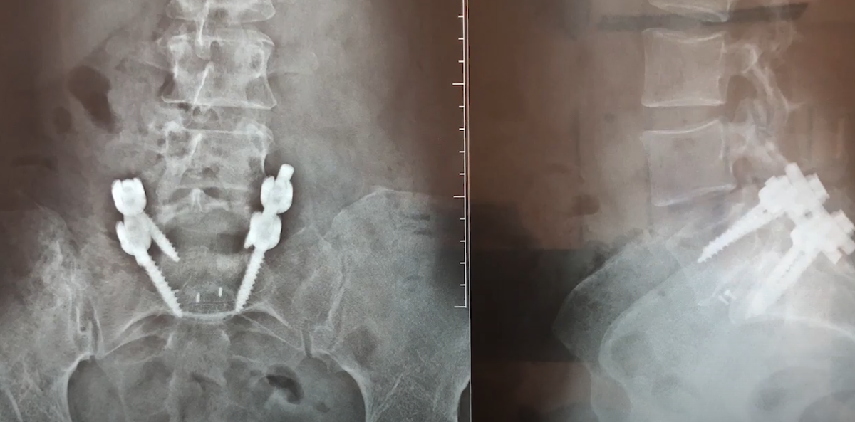 Стабилизация по Хармсу