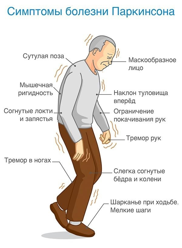 Клиническая картина болезни паркинсона
