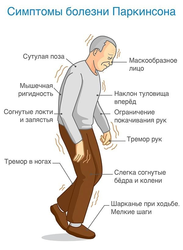 Что за болезнь паркинсона симптомы и признаки фото