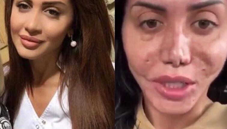 Все изображения использованные в этой статье были взяты с сайта 4tololo.ru и принадлежат их авторам.