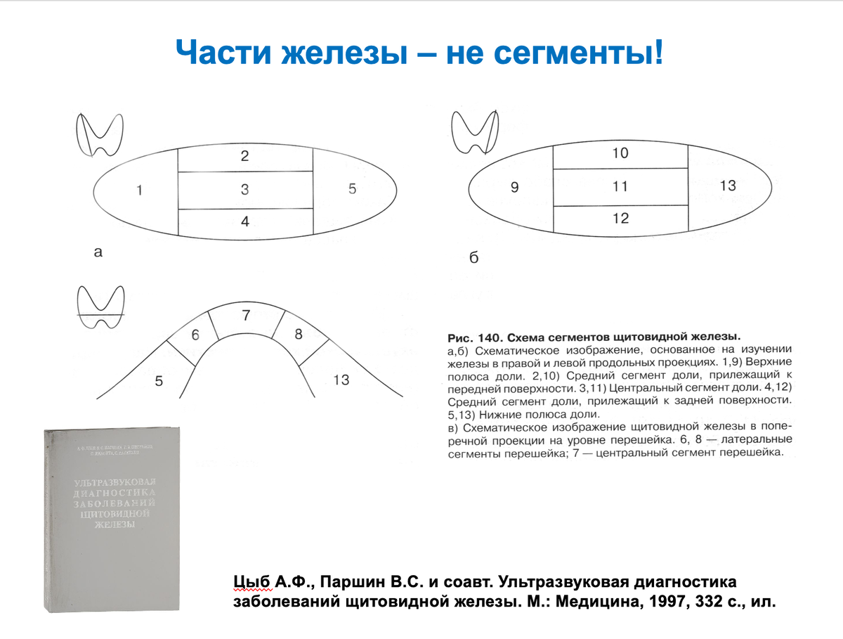 Сегменты доли щитовидной железы. Щитовидная железа строение. Сегменты щитовидной железы. Сегменты щитовидной железы. Верхний полюс щитовидной железы на узи.