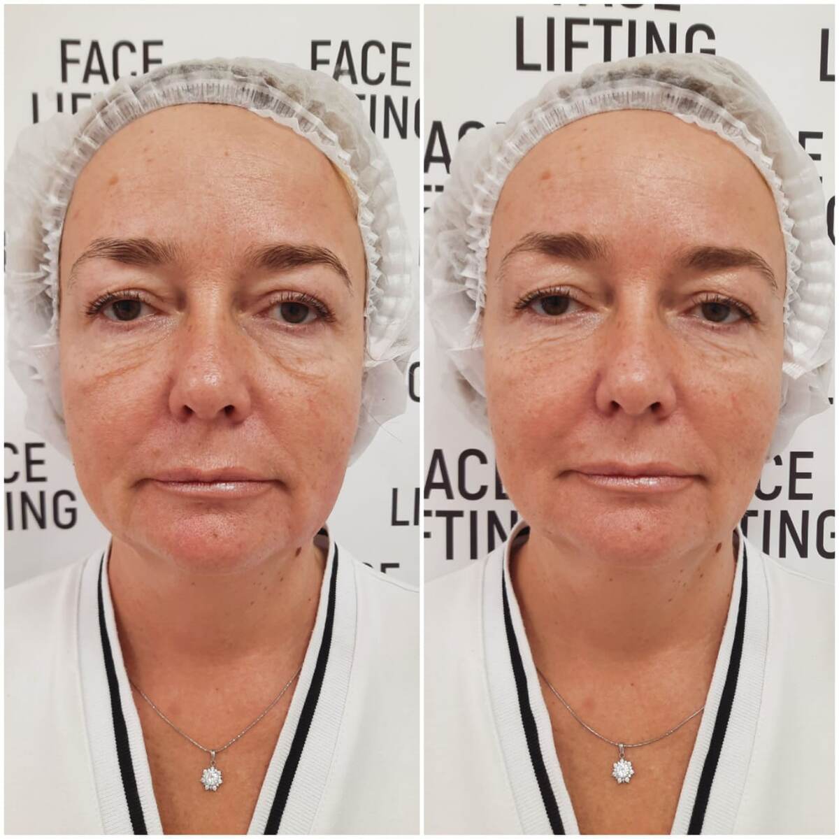 Клиника эстетической медицины и косметологии FaceLifting Москва