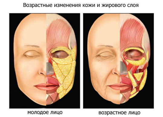 Кожа — Википедия