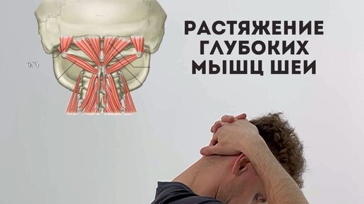 Растяжение шейных мышц