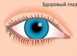 Но причины воспаления слизистой оболочки глаз могут быть разными, и от этого зависит, какое лечение будет назначено.