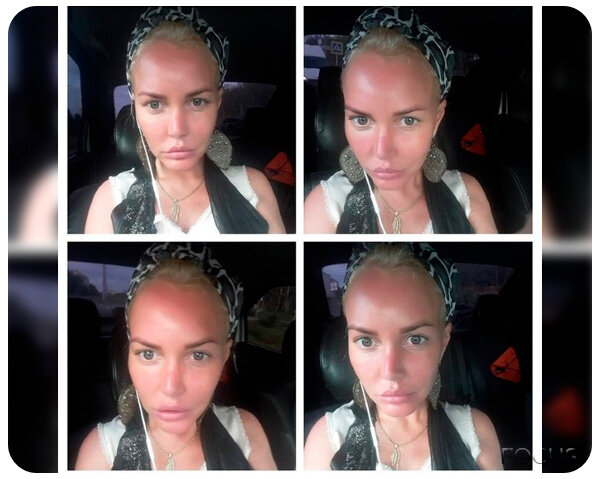 Как выглядит Маша Малиновская после новой неудачной пластики - Рамблер/женский