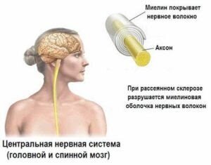Рис. из открытых источников.