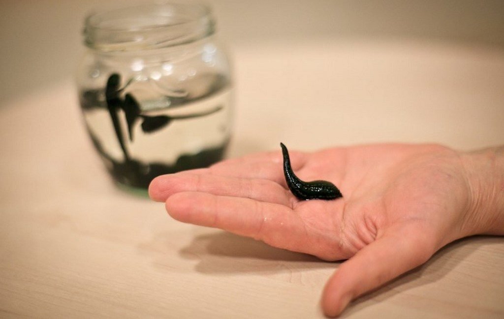 Сеансы гирудотерапии оказывают эффективное воздействие при сильных радикулитных болях, позволяя избавиться от них уже на третьем-четвертом сеансе. Пиявки воздействуют на биологически активные точки, снимая болевые симптомы, их воздействие сопоставимо с эффектом от иглоукалывания.

Фермент гирудин снимает воспаление и улучшает состояние кровеносных сосудов. Вывод токсинов и продуктов воспаления с кровью из организма способствует улучшению периферийного кровообращения и обновлению клеток. Радикулитные боли не только исчезают на время проведения курса, но и не возвращаются впоследствии на протяжении длительного времени.