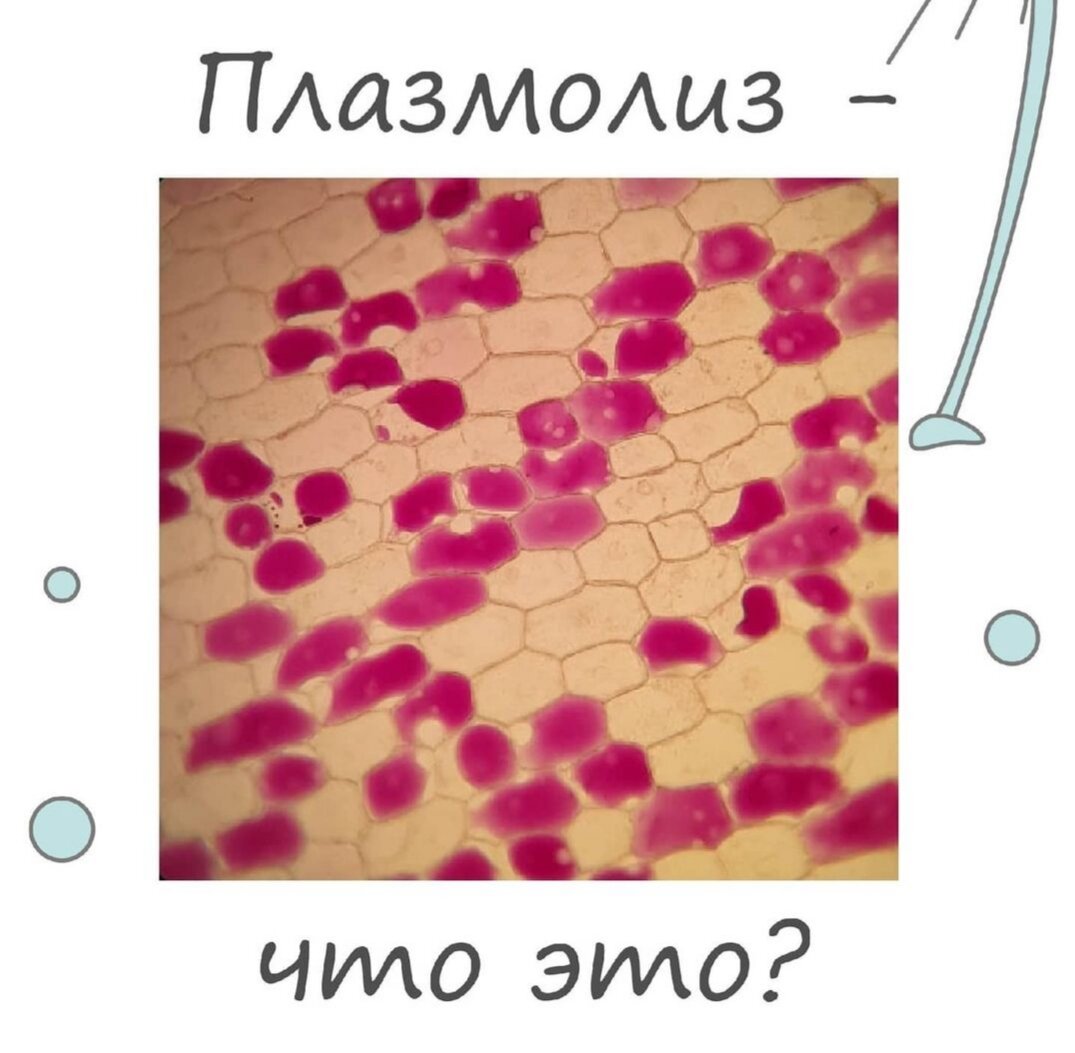 Плазмолиз раствор. Осмос тургор плазмолиз. Плазмолиз гемолиз тургор. Плазмолиз и деплазмолиз гемолиз. Деплазмолиз эритроцитов.