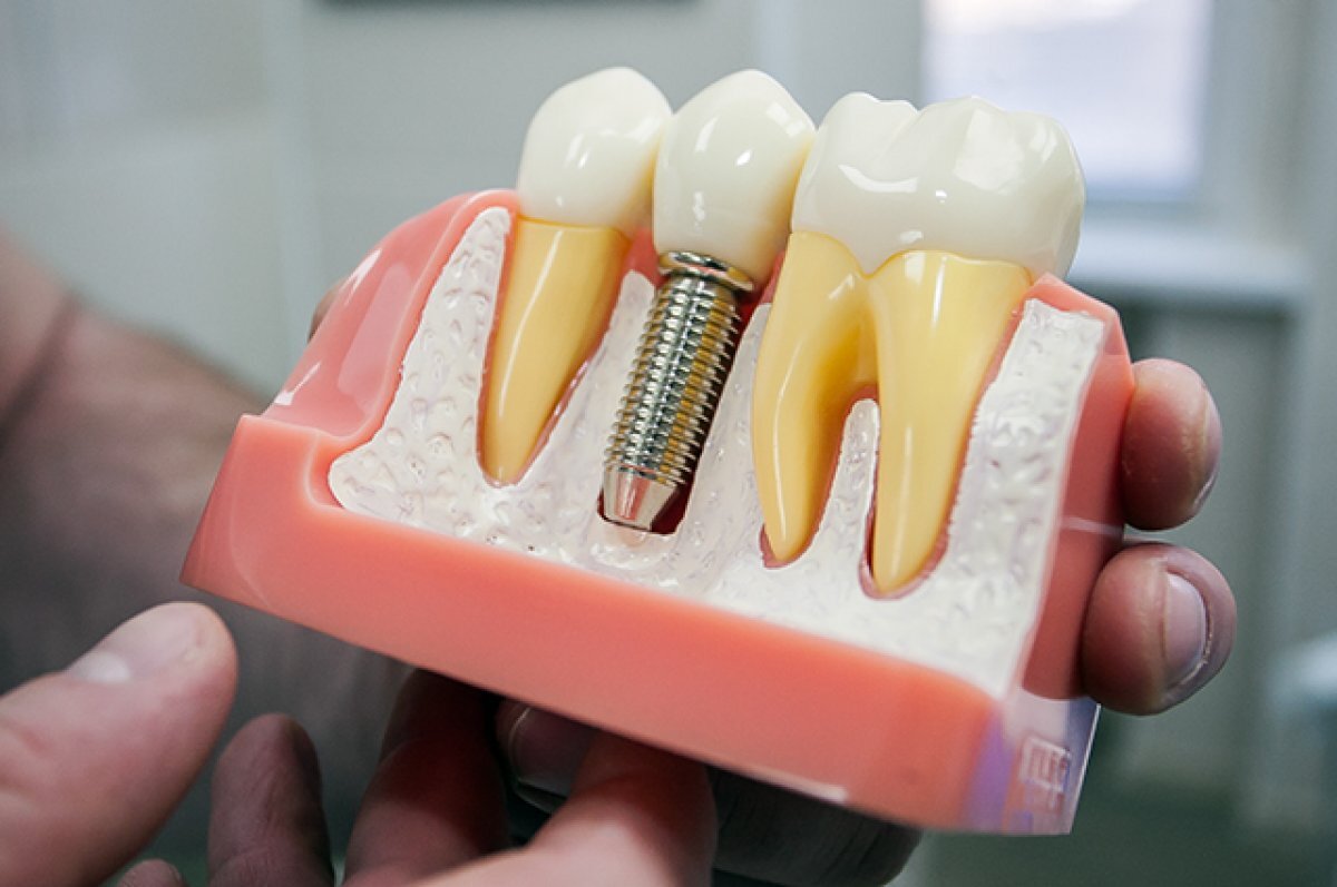    Не все 32. Из-за гнилых зубов могут болеть горло, сердце, суставы и почки