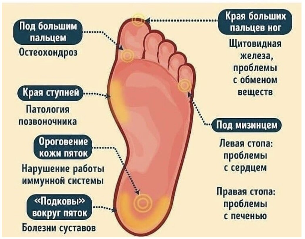 Трещина между пальцами на ногах: причины и методы лечения