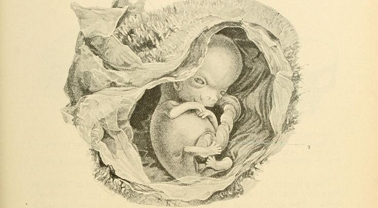   Philadelphia and New York, Lea brothers & co. / Francis A. Countway Library of Medicine / Open Knowledge Commons