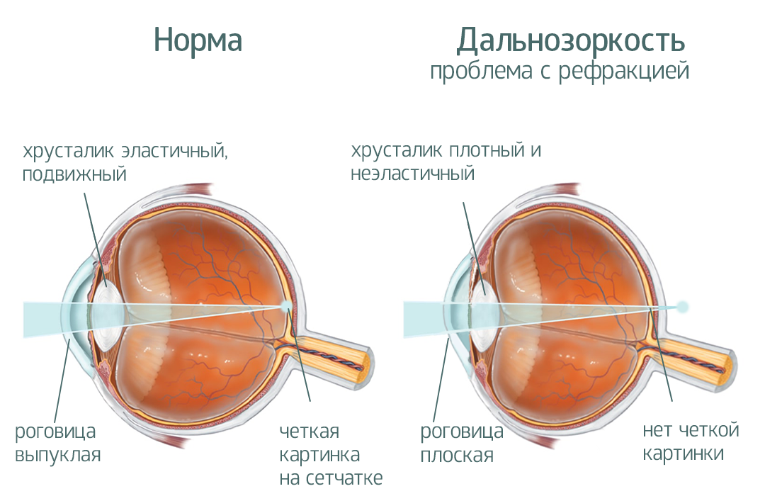 От каких лекарств может пострадать Ваше зрение