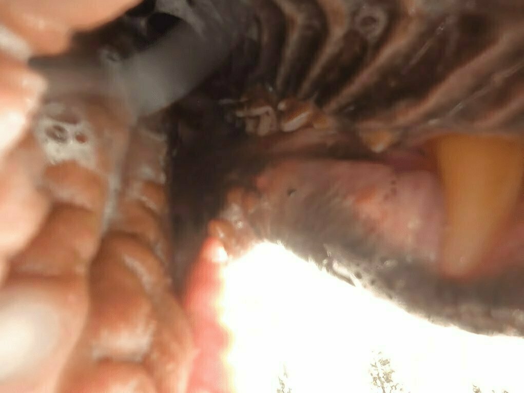 -2