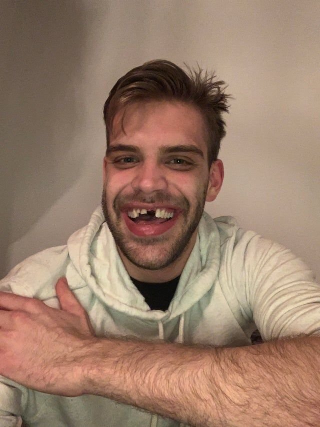 -2